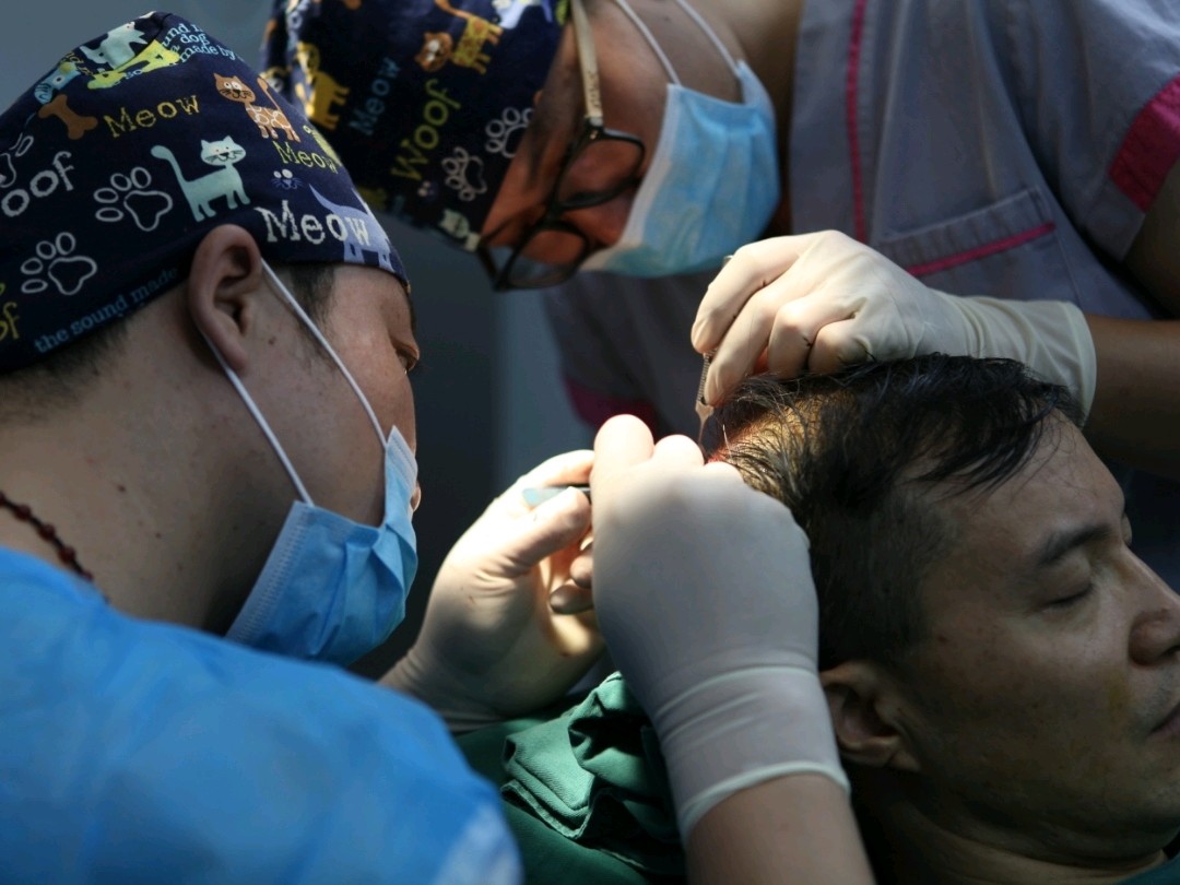 【整形医生躺上了手术台】从"头"开始体验植发项目