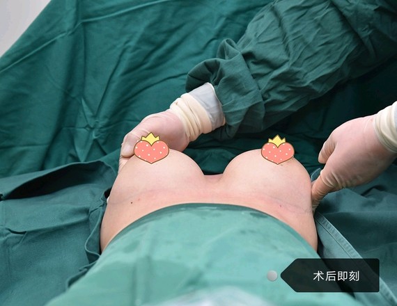 9999乳房对于女_圈子-新氧美容整形