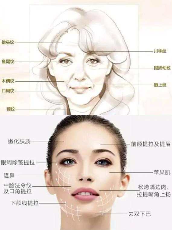 99990205别恐惧年龄给你的面部沧桑_圈子-新氧美容整形