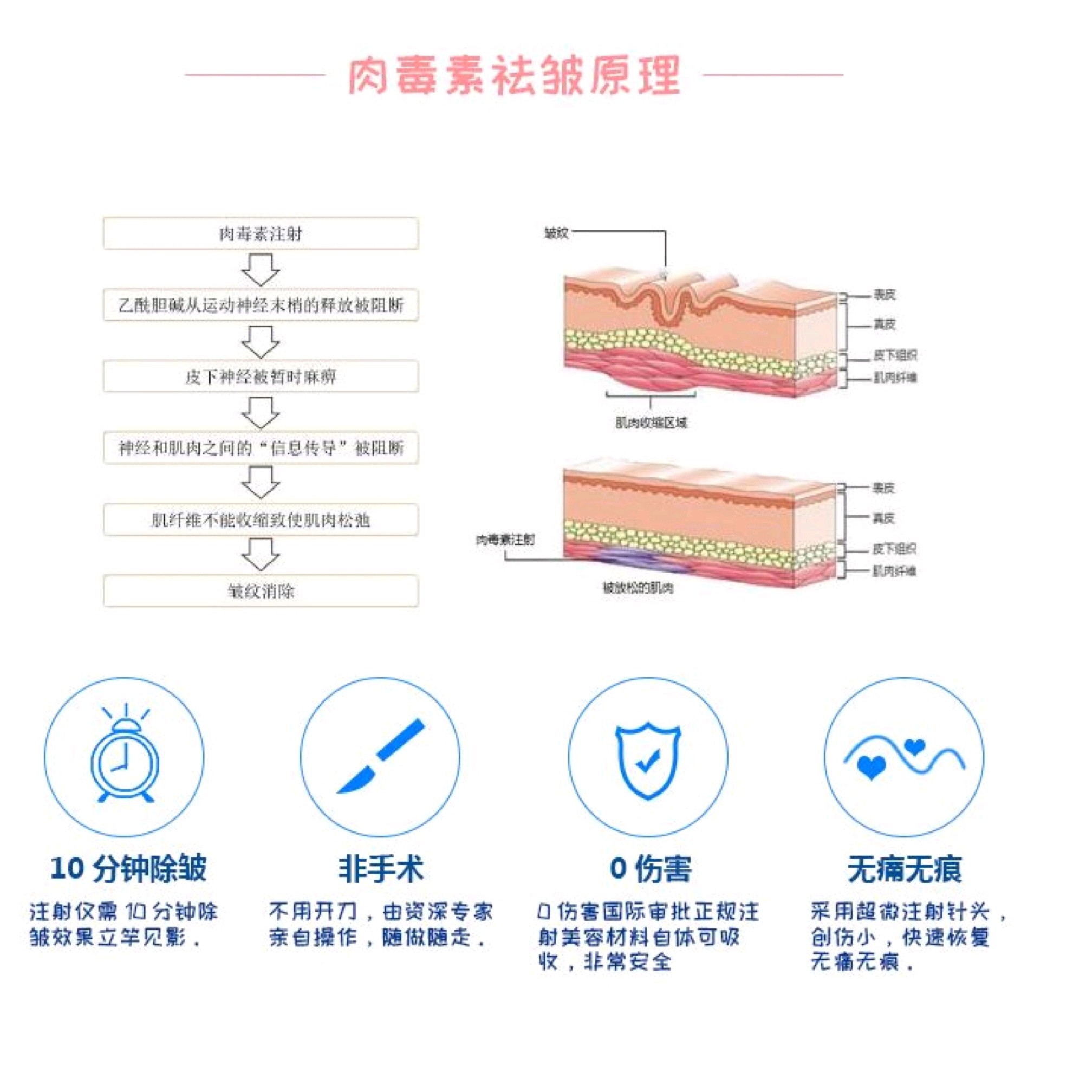 肉毒素除皱你了解多少71科普篇