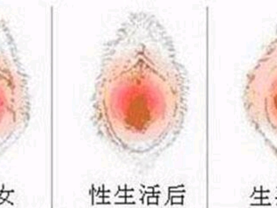 [:32][:32][:32]做处女膜修复后,会被_圈子-新氧美容整形