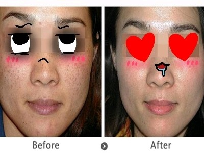 都是 就开始纳闷了 明明自己夏天防晒做的那么好 为什么脸上会长斑呢