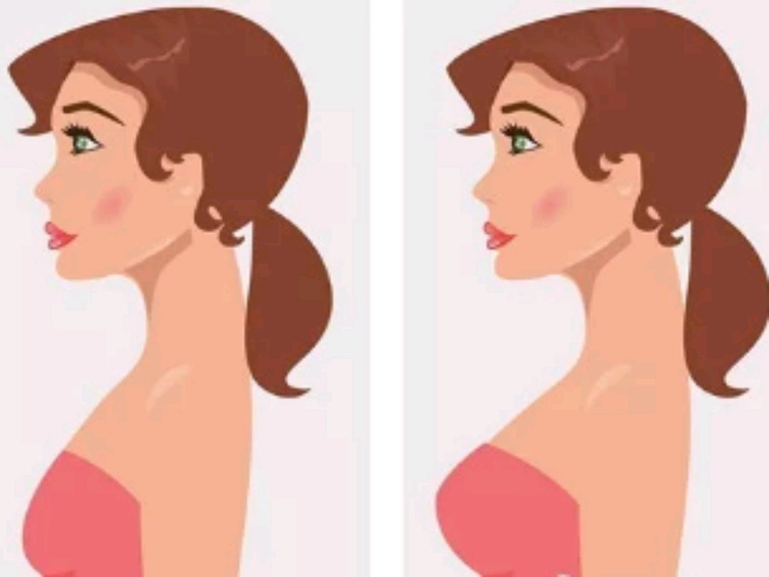 假体隆胸术后采用哪些方式可以恢复的更好?