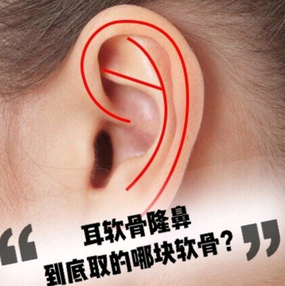 耳骨在哪个位置示意图图片