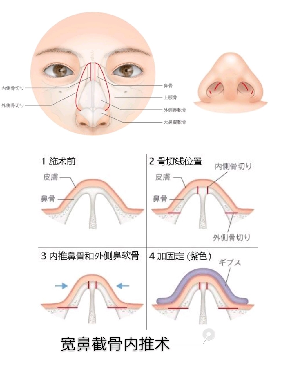 鼻子各部位名称图解图片