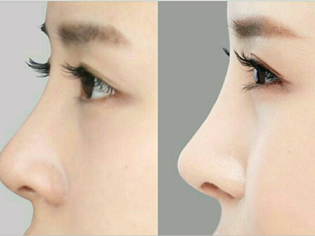 都说美鼻山根起哪里才是山根最美的起点717171