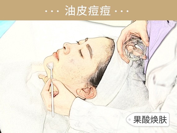 沈梦辰带杜海涛挤痘痘,疼哭杜海涛,祛痘真有这