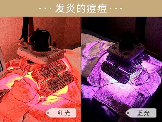 沈梦辰带杜海涛挤痘痘,疼哭杜海涛,祛痘真有这