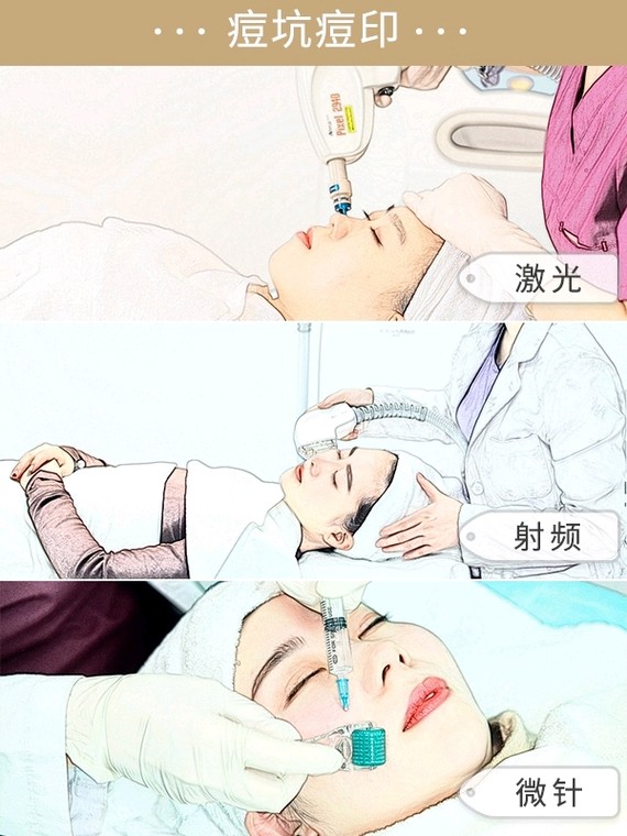 沈梦辰带杜海涛挤痘痘,疼哭杜海涛,祛痘真有这