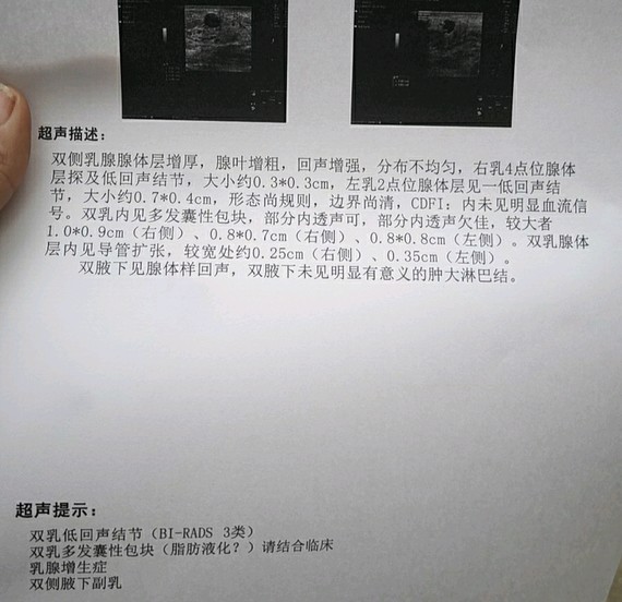 提问帖