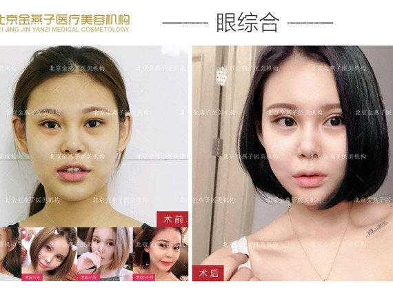 眼睛对于颜值的重要性毋庸置疑一次成功的双眼