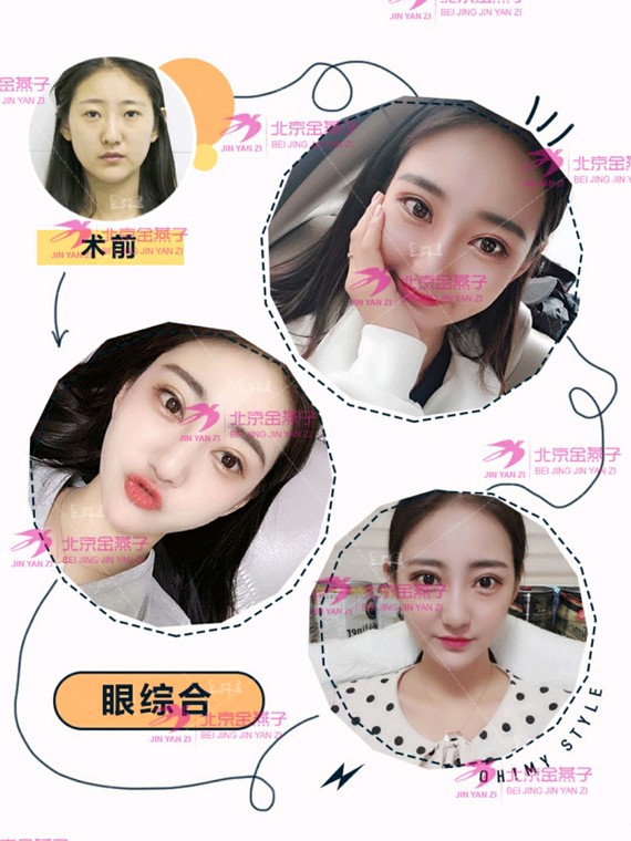 眼睛对于颜值的重要性毋庸置疑一次成功的双眼