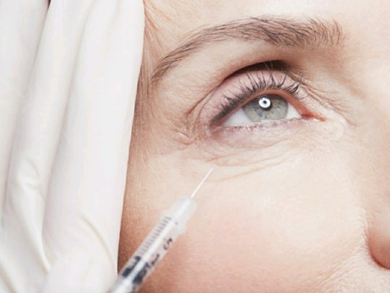 微创手术除皱与非手术除皱,哪种适合你?随着人