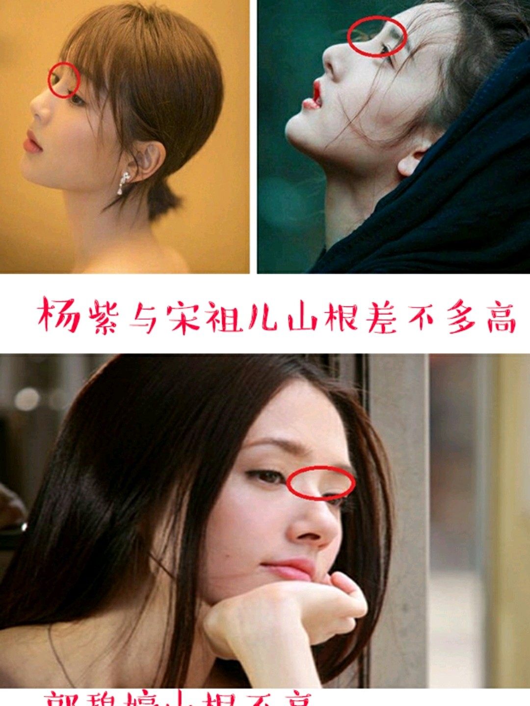 get了阿凡达同款山根,鼻子却依然不高?