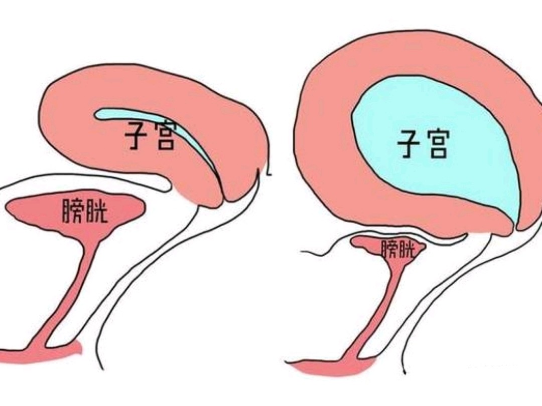 女性天冷勿憋尿否則會誘發泌尿系統疾病!