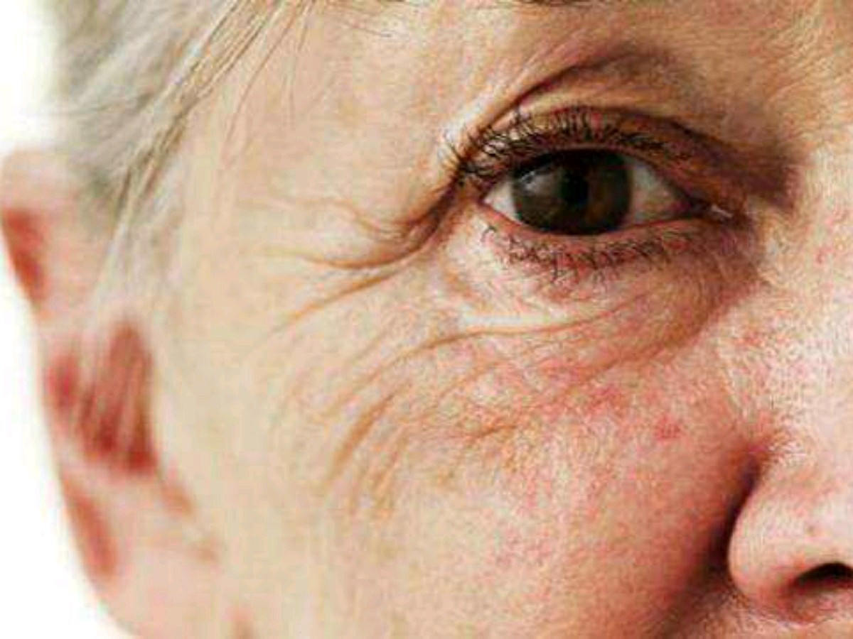 细胞抗衰,逆龄肤质大全每位刚步入中老年的人,都会关