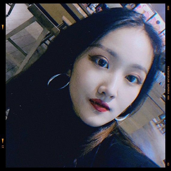 怎样防止发际线后移?植发是唯一能够对光秃区