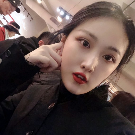 怎样防止发际线后移?植发是唯一能够对光秃区