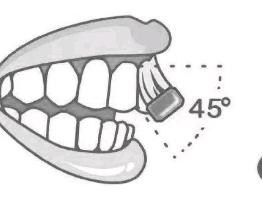 巴氏刷牙法:1/牙刷45度向牙龈2/稍微用力朝牙
