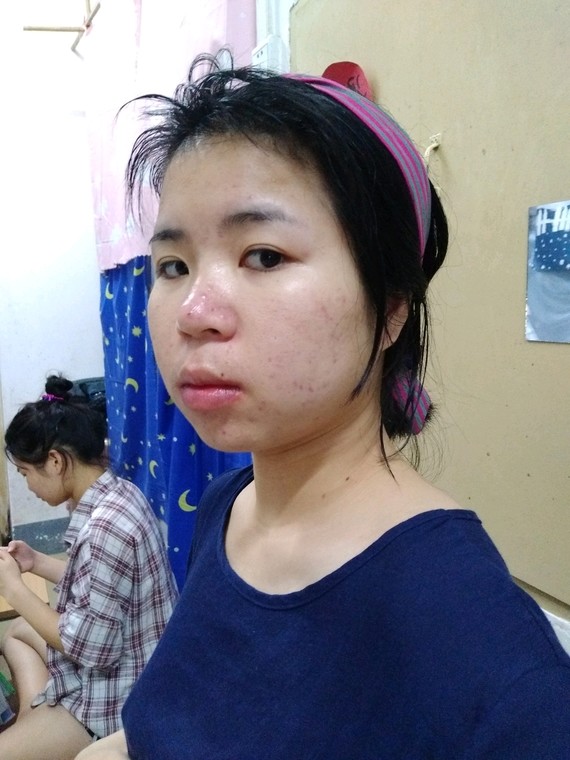 脸骨架大脸上的肉也厚