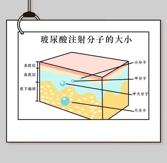 注射玻尿酸后如何避免脸部僵硬7171经常看到娱乐新闻上_圈子-新氧