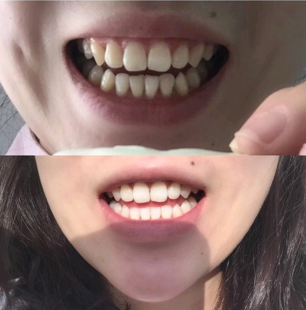 重庆探店今天也是拥有一口07小白牙的精致女孩