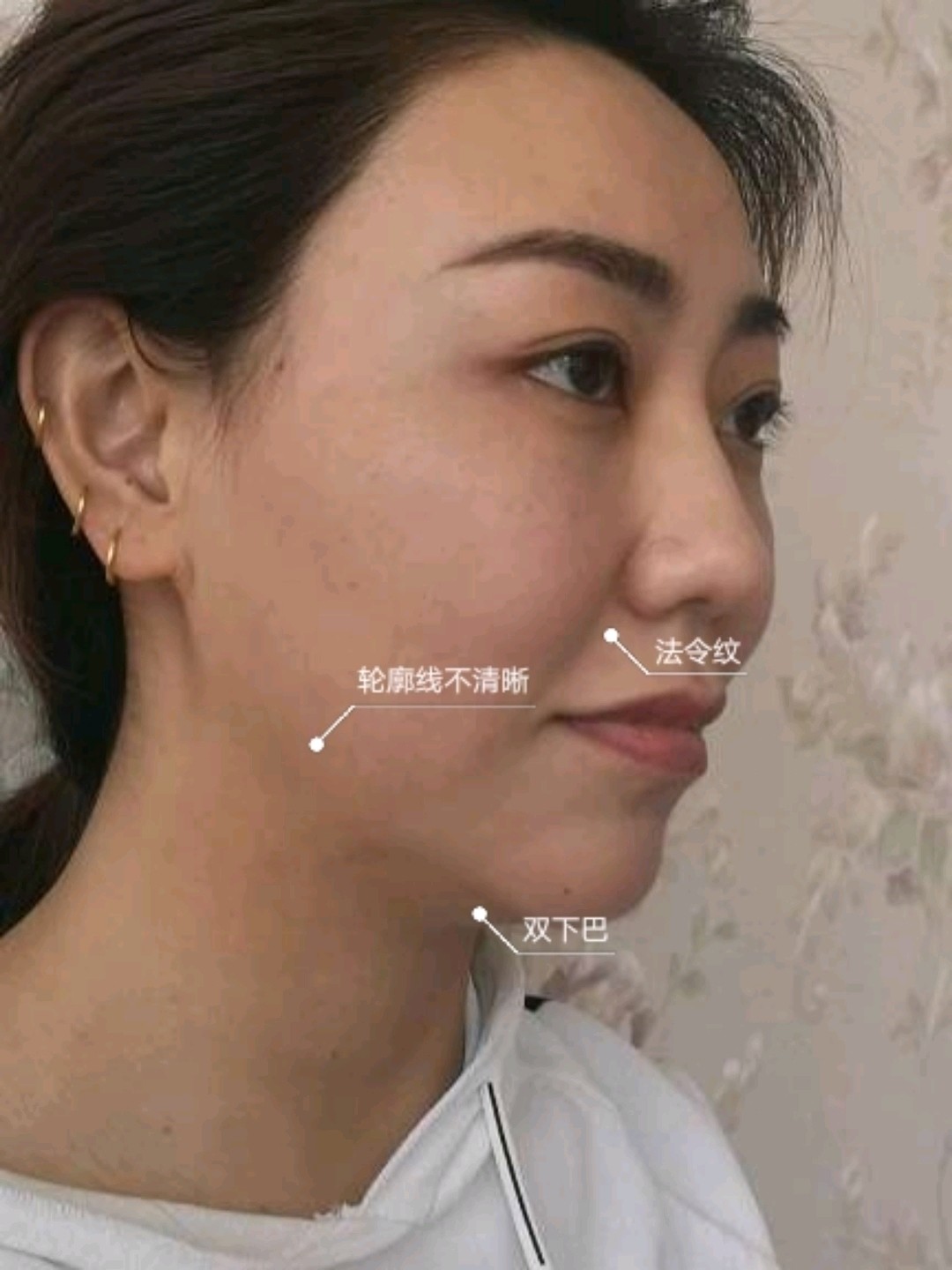 线雕前后对比