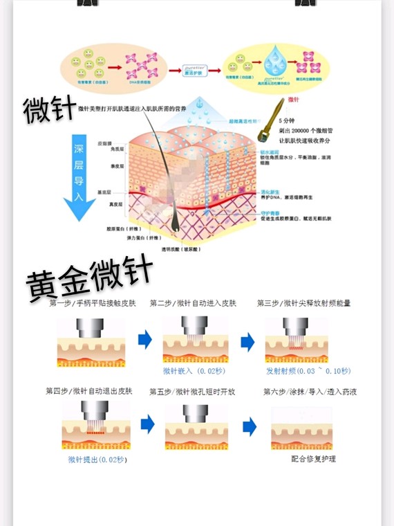 解决表皮问题选微针,黄金微针和微针如何抉择