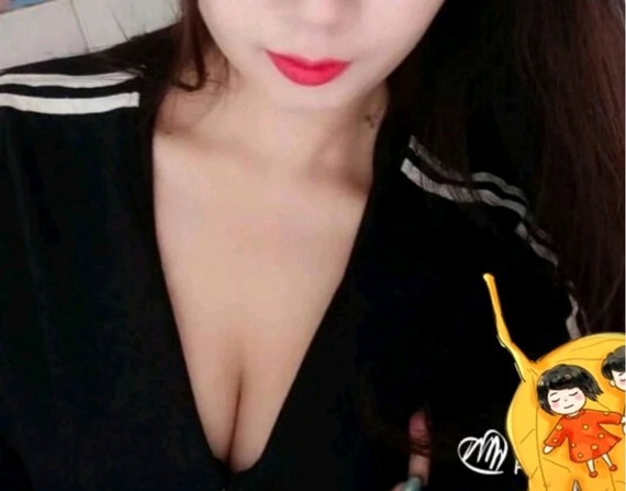 假体丰胸手术安全吗?1、首先,假体植入是目前