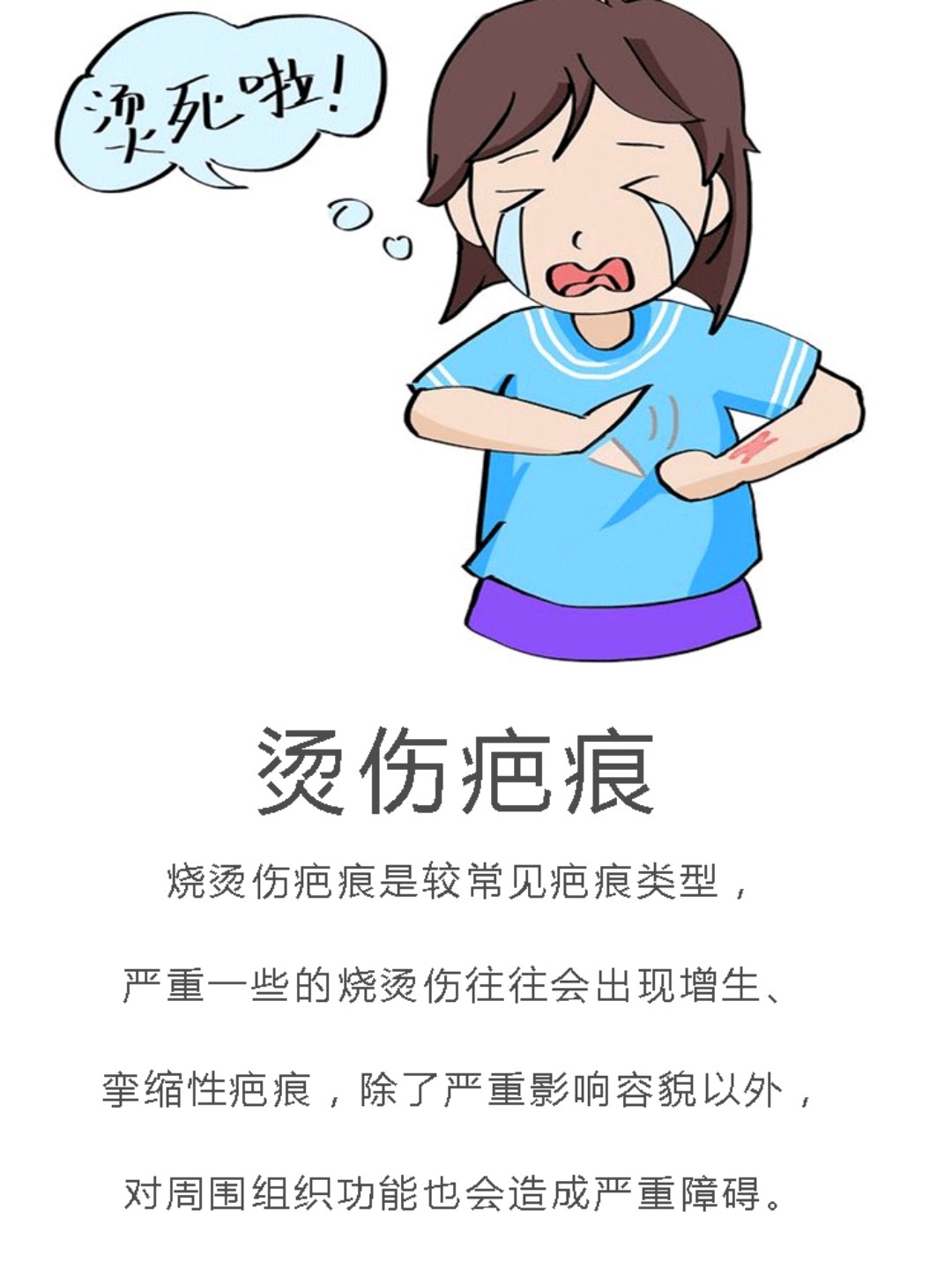 华美hgf联合祛疤技术对烫伤疤痕增生进行科学的分类_圈子-新氧美容