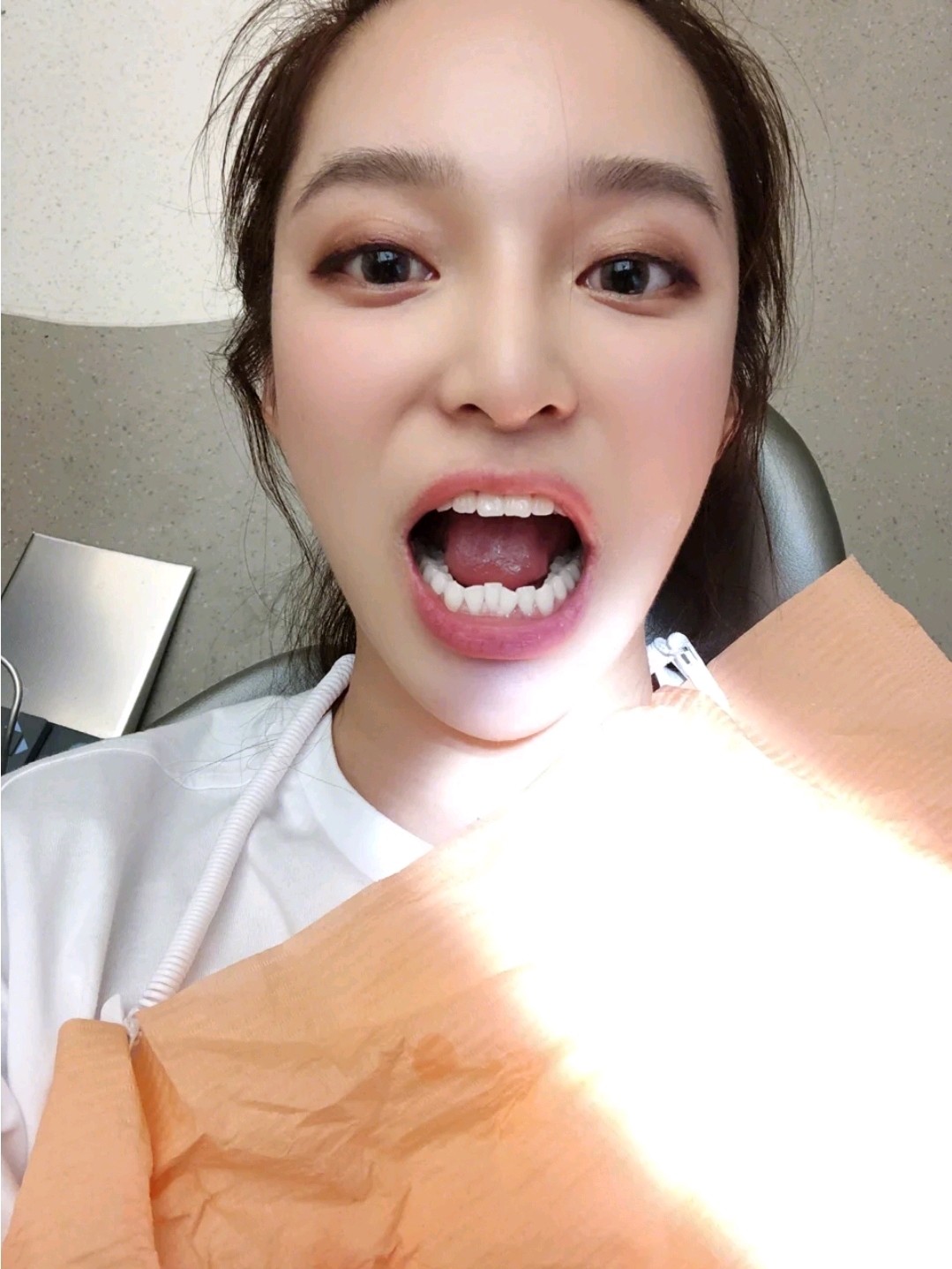 今天来说说洗牙吧 爱美的女孩子都不会放过任何一个细节,牙齿当然也不