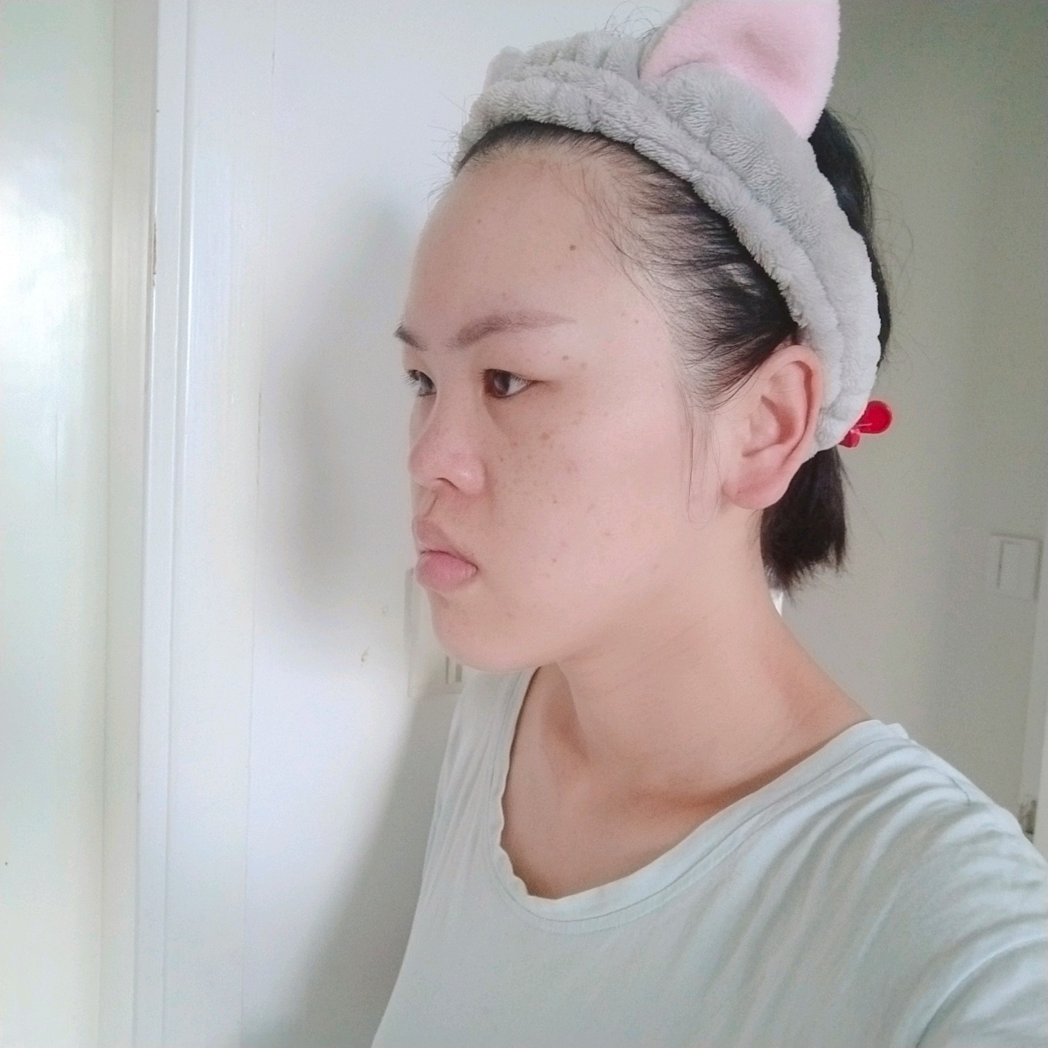 颜值困扰:有点凸嘴 脸偏长 五官不立体 没有山根