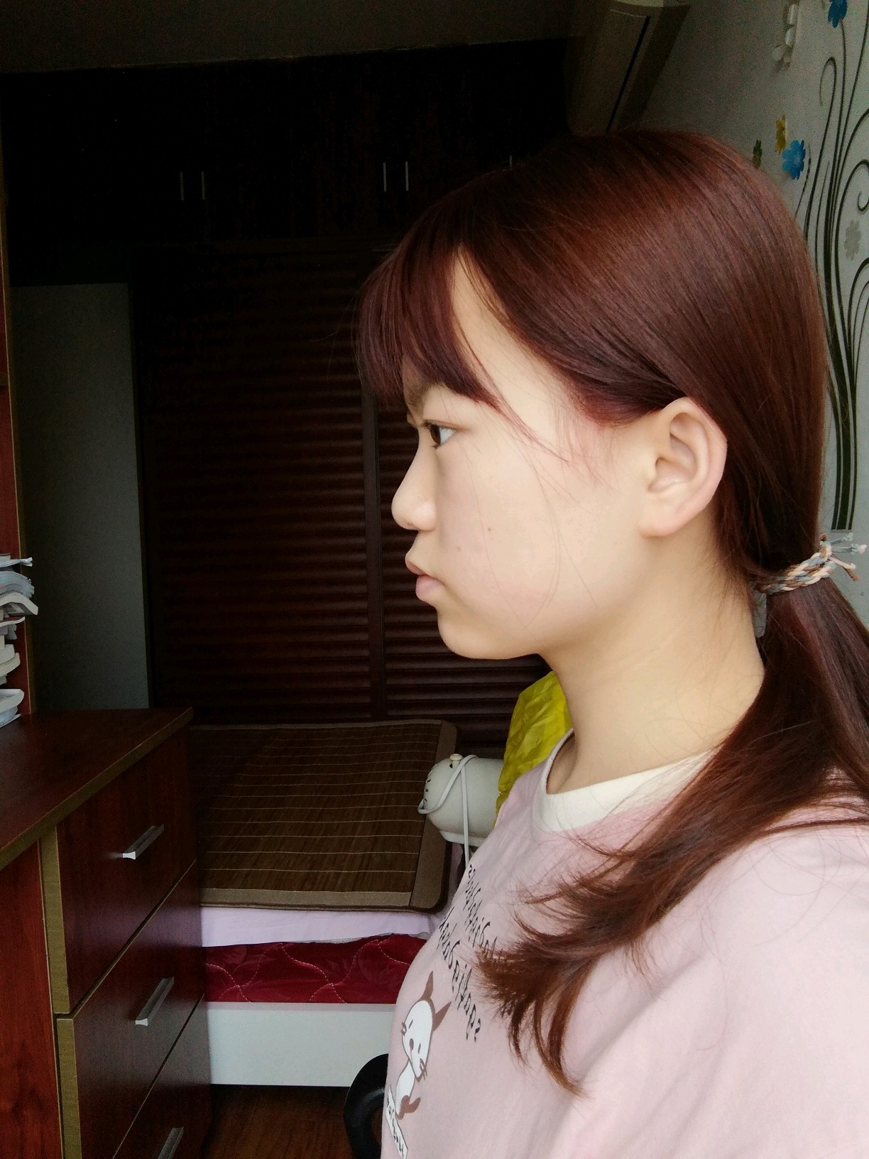 我现在的情况是脸大凸嘴,颧弓外扩,面中凹陷.