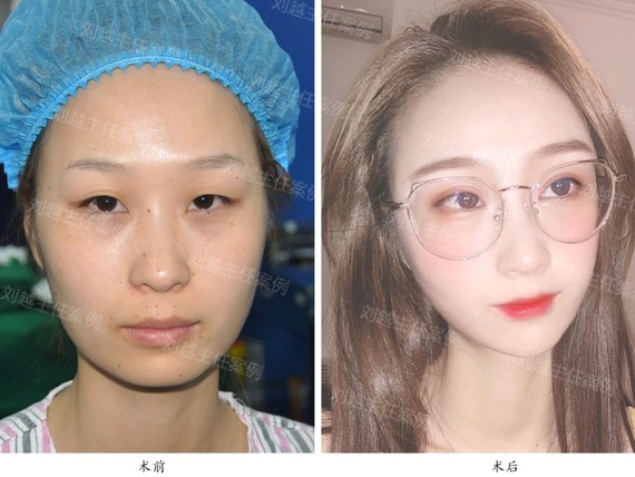 04不少宝宝们因为自己是吊_圈子-新氧美容整形