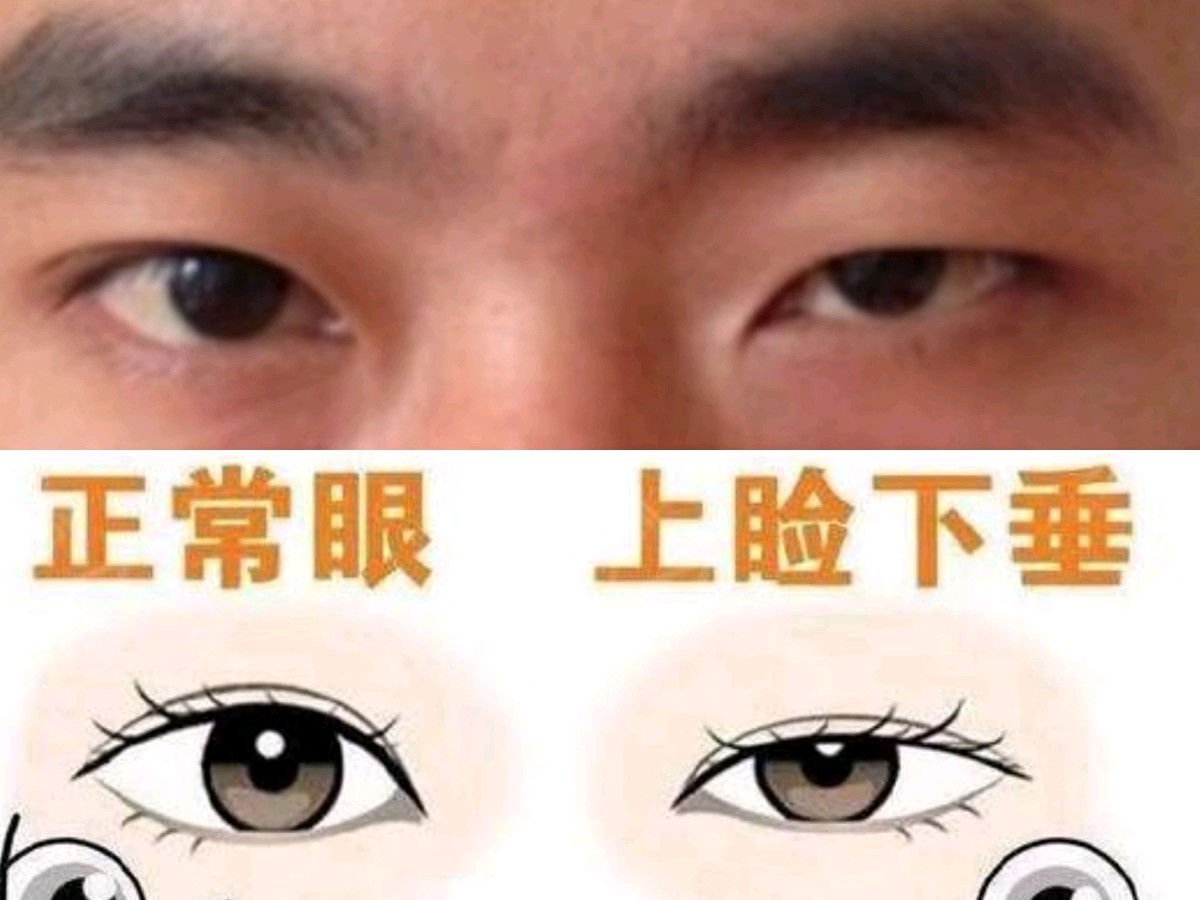 整形医生科学解读面相 面相学靠谱吗 面相究竟是不是 圈子 新氧美容整形