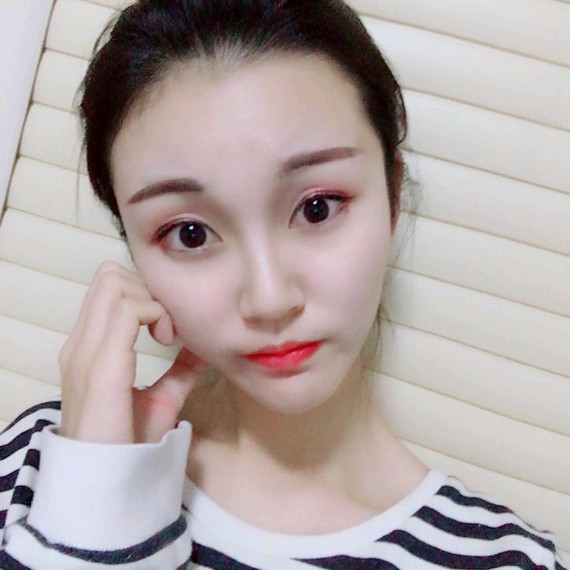 【激光祛斑真的有用吗?快来跟着小琪一起了解