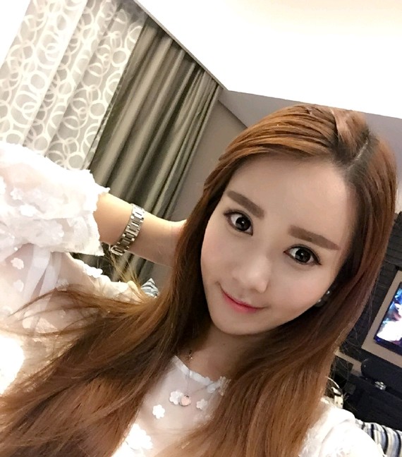 自体脂肪填充多久可以正常上班呢从自体脂肪填