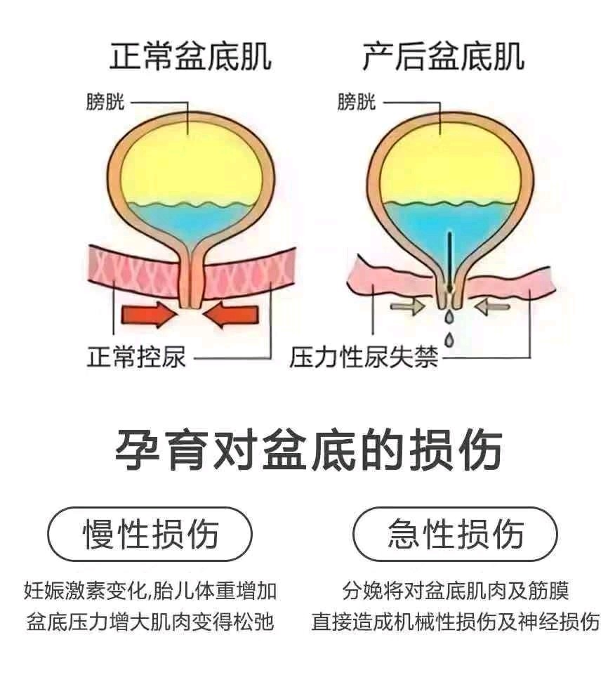 直肠等脏器,具有以下重要功能 括约:承载盆底器官,避免器官脱垂