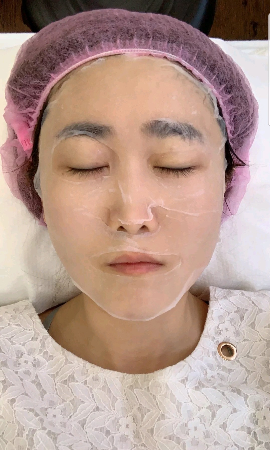 夏季净白肤色的秘密镭射净肤