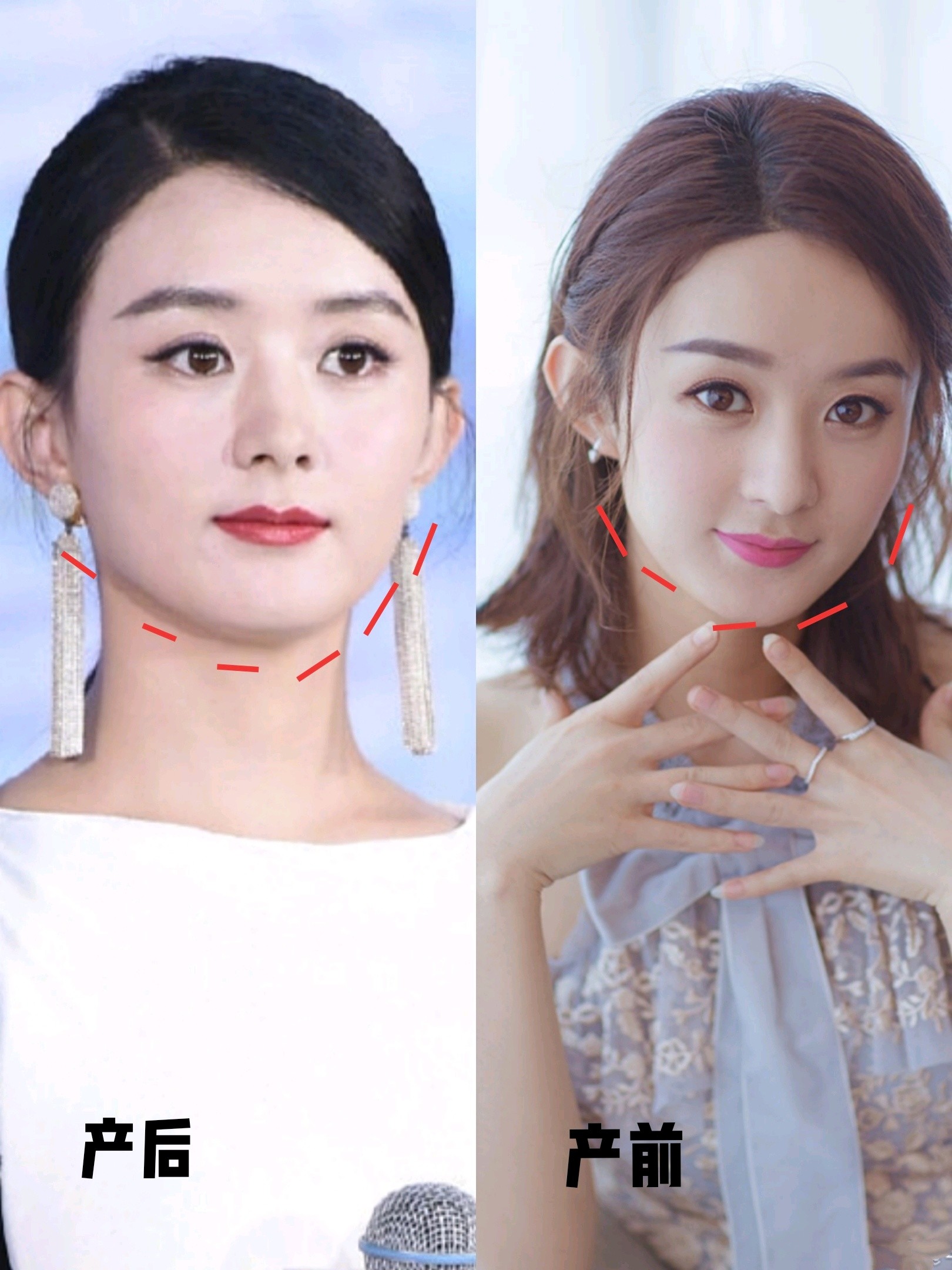 赵丽颖复工,颖宝,你怎么肿了