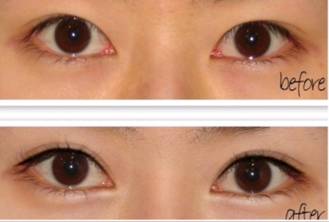 内眼角和外眼角有什么区别?