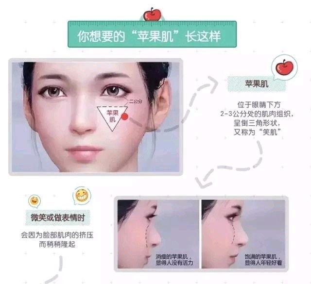 许多影视明星都非常喜欢注射苹果肌,因为注射了苹果肌的脸,看上去更加