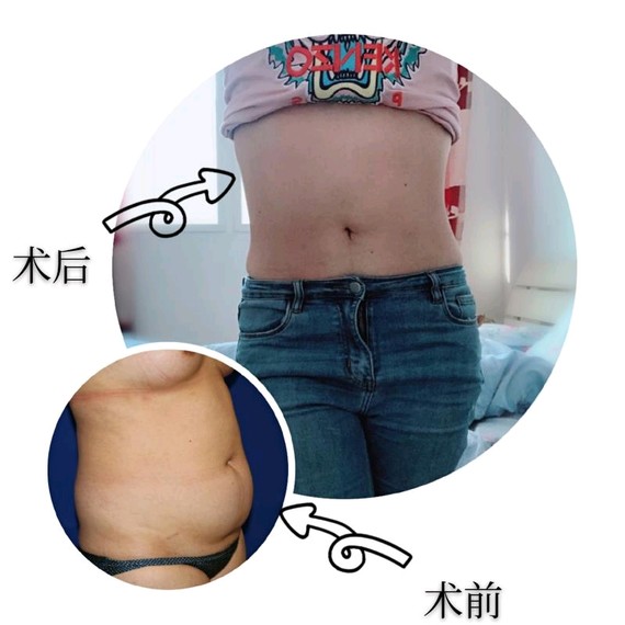 宝妈的烦恼产后如何快速恢复身材 产后怎么才