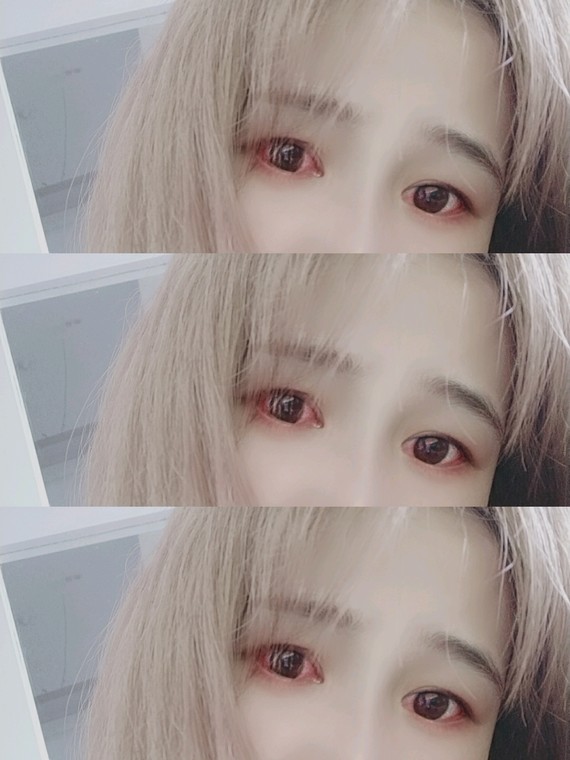 来分享一个红眼女孩的照片9898_圈子-新氧美容整形