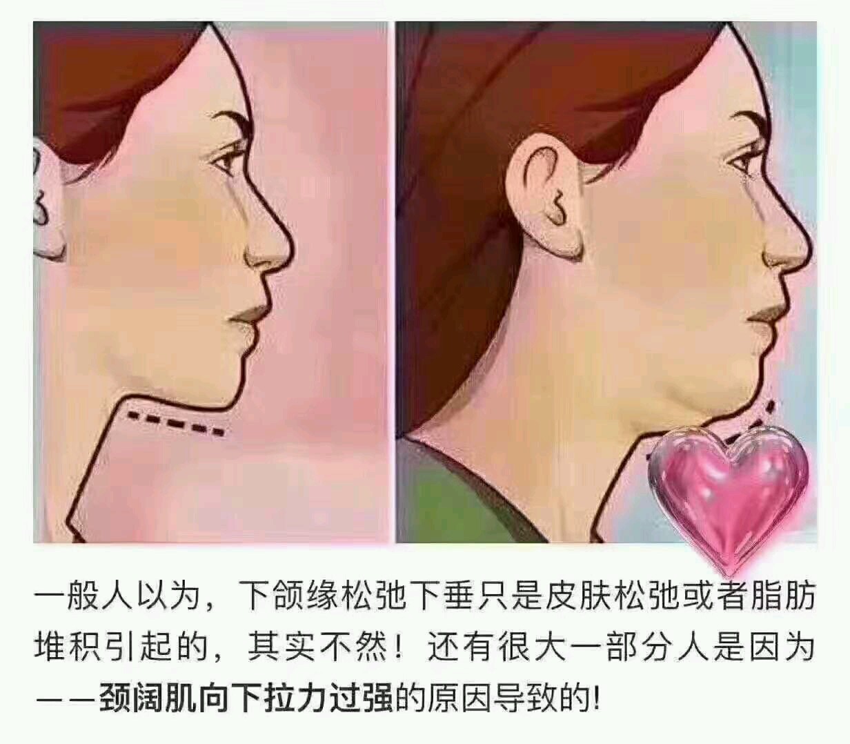 搭配瘦脸针下颌缘提升效果更佳哦