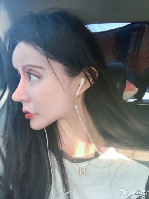 02为什么有的人一眼就能看出整形痕迹之前大火的高