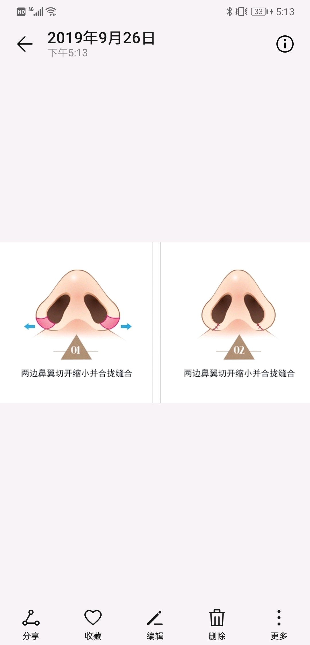 整容可逆吗 整形失败能否恢复到术前 在整形需求 圈子 新氧美容整形