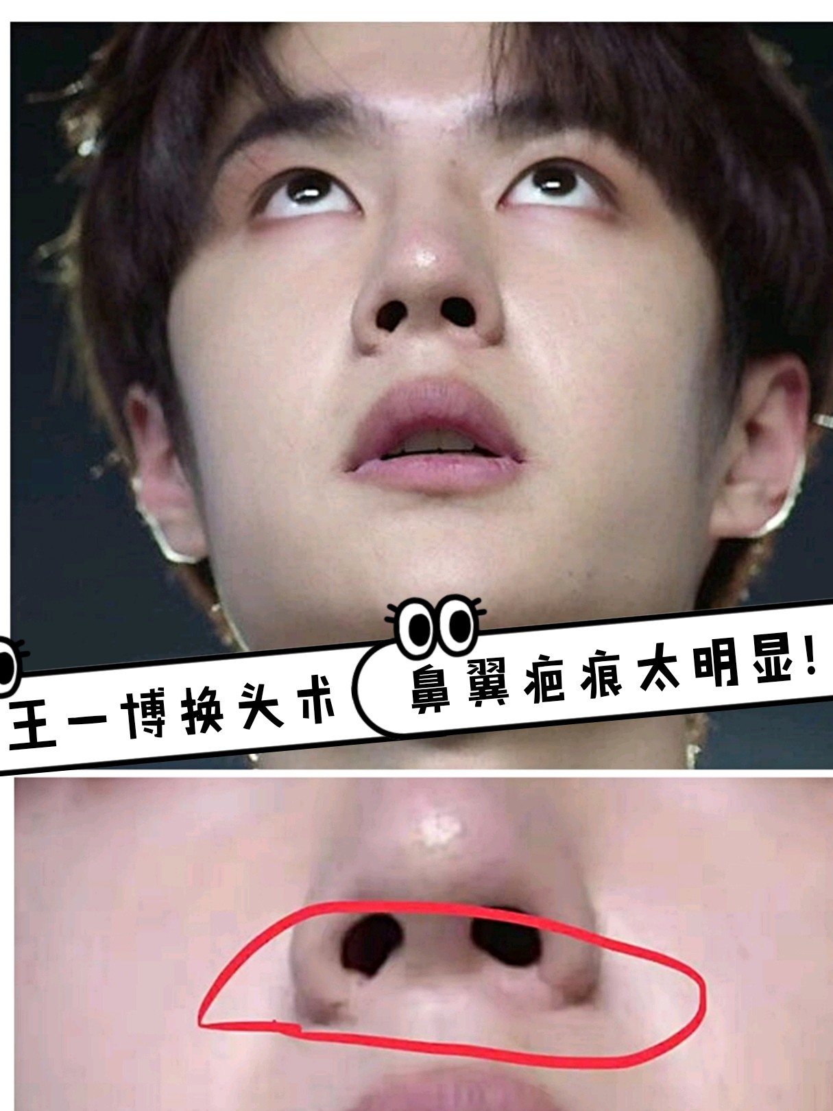 王一博换头术 鼻翼疤痕太明显?