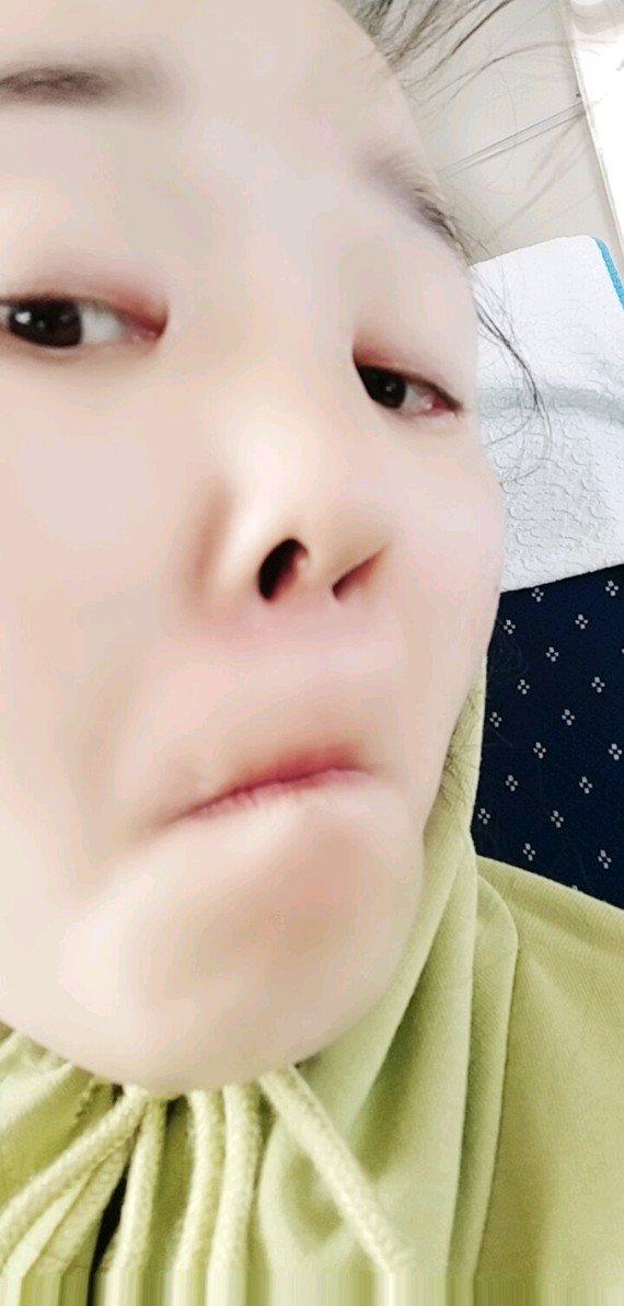 [cp]【黑榜】医院:南京华美整形医院,欺骗我他