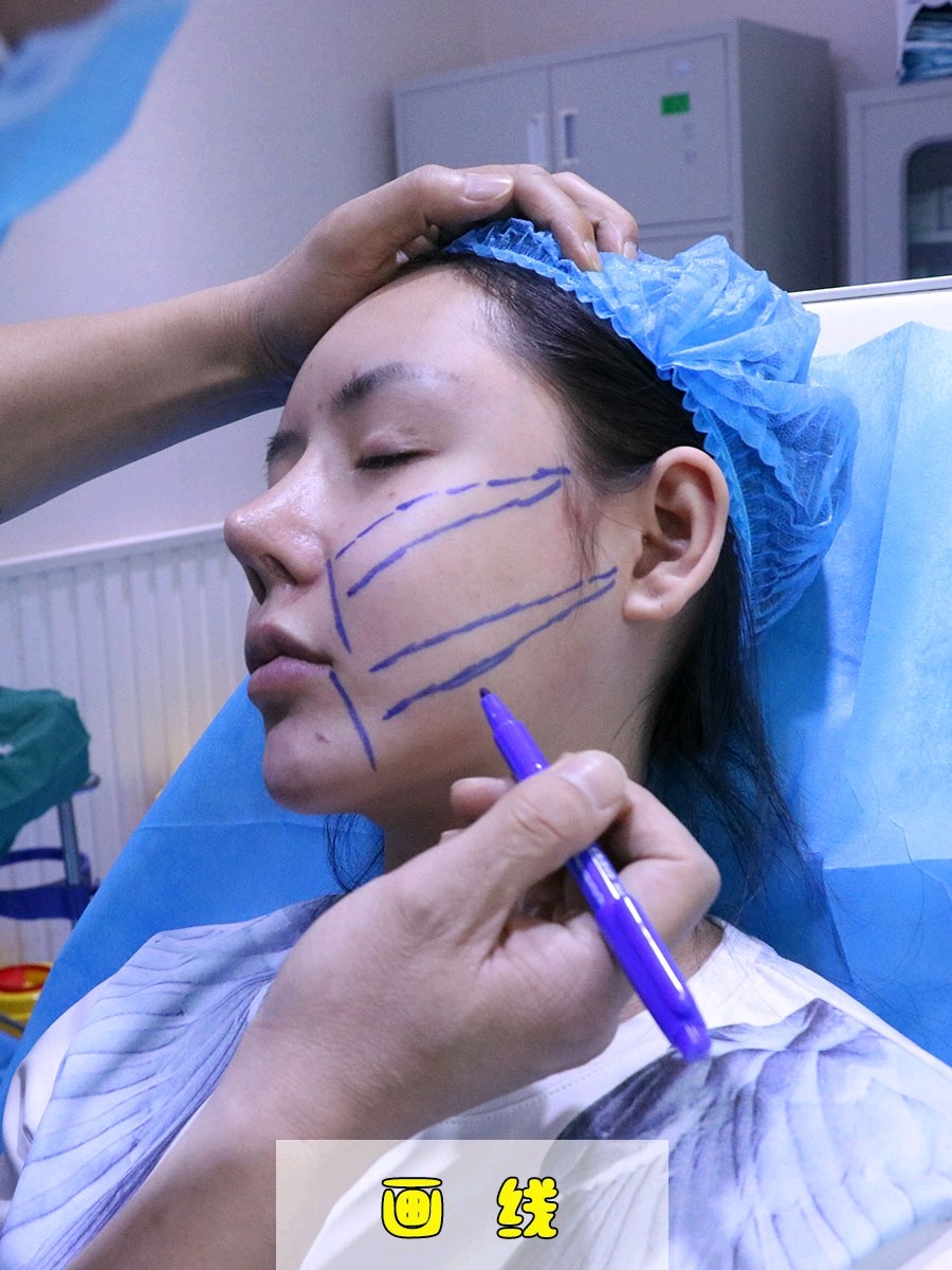 这样做能延长线雕效果!